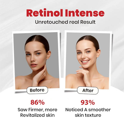 Retinol Intense Cream 0.1%