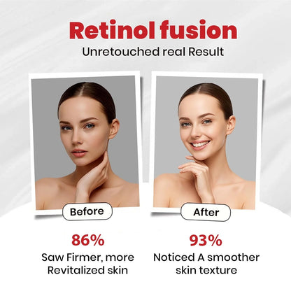 Retinol Fusion Cream 0.05%